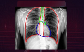 nube pública de IBM