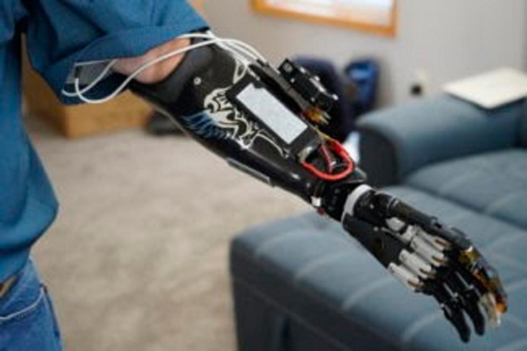 NVIDIA Jetson Nano puede leer tu mente para que puedas controlar Far Cry 5 y un brazo protésico con tu pensamiento