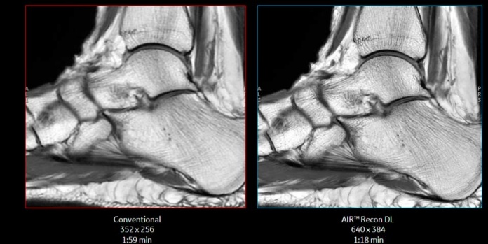 Tecnología con inteligencia artificial y algoritmos avanzados mejora precisión de diagnósticos y eficiencia de los centros de salud