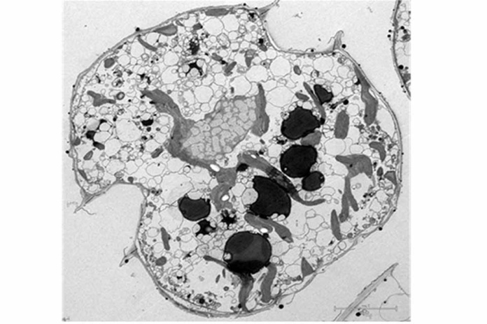 Estudio colaborativo realizó análisis proteómico y toxicológico de respuesta de Alexandrium catenella a cambios en la concentración del Nitrato de Sodio Estudio colaborativo realizó análisis proteómico y toxicológico de respuesta de Alexandrium catenella a cambios en la concentración del Nitrato de Sodio