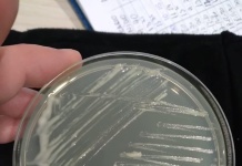 Investigadores INCAR describen nueva especie bacteriana de Tenacibaculum