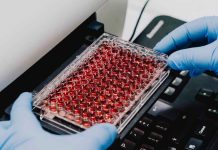 Científicos crean un “ñache biotecnológico” a partir de la sangre de cerdo y obtienen tres ingredientes Científicos crean un “ñache biotecnológico” a partir de la sangre de cerdo y obtienen tres ingredientes